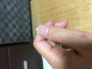ぱるにやられた私の親指です。。。